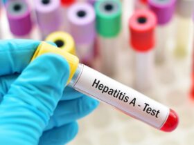 Representation for Hepatitis A testing | Credits: Google Images