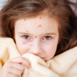 Measles Outbreak in Florida Elementary School